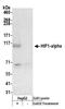 Hypoxia-inducible factor 1-alpha antibody, A500-016A, Bethyl Labs, Western Blot image 