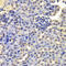 LSM4 Homolog, U6 Small Nuclear RNA And MRNA Degradation Associated antibody, A07672-1, Boster Biological Technology, Immunohistochemistry frozen image 