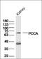 Propionyl-CoA Carboxylase Subunit Alpha antibody, orb312578, Biorbyt, Western Blot image 