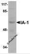 INSM Transcriptional Repressor 1 antibody, 5415, ProSci, Western Blot image 