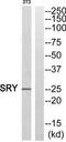 Sex-determining region Y protein antibody, TA313035, Origene, Western Blot image 