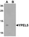 Protein yippee-like 5 antibody, A15188, Boster Biological Technology, Western Blot image 