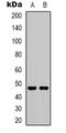 5-Hydroxytryptamine Receptor 2C antibody, LS-C368871, Lifespan Biosciences, Western Blot image 