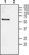 NRG-1 antibody, PA5-77531, Invitrogen Antibodies, Western Blot image 