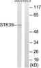 Serine/Threonine Kinase 39 antibody, TA326246, Origene, Western Blot image 