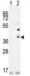 Vegi antibody, AP54314PU-N, Origene, Western Blot image 