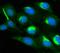 P21 (RAC1) Activated Kinase 1 antibody, A00454-2, Boster Biological Technology, Immunofluorescence image 