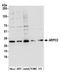 Actin Related Protein 2/3 Complex Subunit 2 antibody, A305-394A, Bethyl Labs, Western Blot image 
