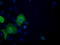 ATP Citrate Lyase antibody, TA501031S, Origene, Immunofluorescence image 