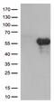 Hepatitis A Virus Cellular Receptor 2 antibody, CF812572, Origene, Western Blot image 