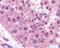 Melanoma-associated antigen 2 antibody, 49-712, ProSci, Immunohistochemistry frozen image 