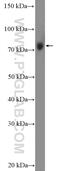 DExH-Box Helicase 58 antibody, 11355-1-AP, Proteintech Group, Western Blot image 