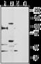 Transient Receptor Potential Cation Channel Subfamily V Member 5 antibody, GTX54868, GeneTex, Western Blot image 
