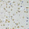 Ribonuclease L antibody, 23-936, ProSci, Immunohistochemistry paraffin image 