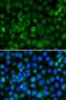HPS1 Biogenesis Of Lysosomal Organelles Complex 3 Subunit 1 antibody, orb373434, Biorbyt, Immunofluorescence image 