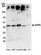 Deoxyhypusine synthase antibody, A304-375A, Bethyl Labs, Western Blot image 