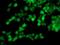 Translocase Of Outer Mitochondrial Membrane 34 antibody, NBP2-00892, Novus Biologicals, Immunocytochemistry image 