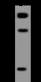 Zinc Finger And BTB Domain Containing 16 antibody, 200261-T32, Sino Biological, Western Blot image 