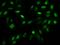 AF4/FMR2 Family Member 3 antibody, 205373-T02, Sino Biological, Immunohistochemistry paraffin image 