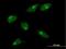 Mannosyl (Alpha-1,3-)-Glycoprotein Beta-1,2-N-Acetylglucosaminyltransferase antibody, H00004245-B01P, Novus Biologicals, Immunocytochemistry image 