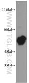 Src Kinase Associated Phosphoprotein 1 antibody, 14724-1-AP, Proteintech Group, Western Blot image 