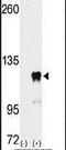 Pumilio homolog 2 antibody, PA5-14814, Invitrogen Antibodies, Western Blot image 