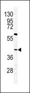 GHRHR antibody, PA5-14407, Invitrogen Antibodies, Western Blot image 