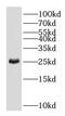Guanidinoacetate N-Methyltransferase antibody, FNab03338, FineTest, Western Blot image 