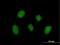 Zinc Finger Protein 710 antibody, H00374655-B01P, Novus Biologicals, Immunocytochemistry image 