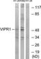 Vasoactive Intestinal Peptide Receptor 1 antibody, TA314669, Origene, Western Blot image 