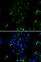 BOC Cell Adhesion Associated, Oncogene Regulated antibody, STJ29254, St John