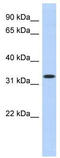 Metallophosphoesterase Domain Containing 2 antibody, TA346297, Origene, Western Blot image 