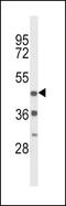 Dopamine Receptor D4 antibody, LS-C167534, Lifespan Biosciences, Western Blot image 