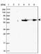 Zinc Finger Protein 577 antibody, PA5-59596, Invitrogen Antibodies, Western Blot image 