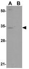 Solute Carrier Family 39 Member 3 antibody, GTX85133, GeneTex, Western Blot image 