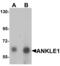 Ankyrin Repeat And LEM Domain Containing 1 antibody, PA5-72735, Invitrogen Antibodies, Western Blot image 