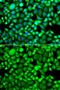 Proteasome Subunit Beta 8 antibody, GTX55763, GeneTex, Immunocytochemistry image 