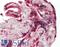 Death-associated protein kinase 1 antibody, LS-B11691, Lifespan Biosciences, Immunohistochemistry paraffin image 