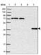 Chromosome 11 Open Reading Frame 54 antibody, NBP1-87193, Novus Biologicals, Western Blot image 