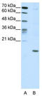 Double Homeobox 5 antibody, TA343685, Origene, Western Blot image 