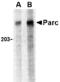 Cullin 9 antibody, A08481-1, Boster Biological Technology, Western Blot image 