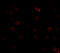 Inhibitor of nuclear factor kappa-B kinase subunit alpha antibody, 2115, ProSci Inc, Immunofluorescence image 