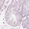 Progestagen Associated Endometrial Protein antibody, NBP1-89782, Novus Biologicals, Immunohistochemistry paraffin image 