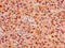 Forkhead Box K1 antibody, CSB-PA008824LA01HU, Cusabio, Immunohistochemistry paraffin image 