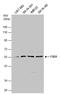Fibronectin Type III And SPRY Domain Containing 1 antibody, GTX131769, GeneTex, Western Blot image 