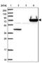 Peptidoglycan Recognition Protein 2 antibody, PA5-61211, Invitrogen Antibodies, Western Blot image 