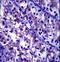 Laminin Subunit Beta 1 antibody, LS-C165670, Lifespan Biosciences, Immunohistochemistry paraffin image 