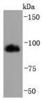 3-Hydroxy-3-Methylglutaryl-CoA Reductase antibody, A00643-2, Boster Biological Technology, Western Blot image 