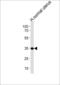 CUB And Zona Pellucida-Like Domain-Containing Protein 1                     antibody, LS-C167163, Lifespan Biosciences, Western Blot image 