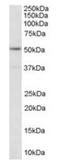 5-Hydroxytryptamine Receptor 2C antibody, orb19008, Biorbyt, Western Blot image 